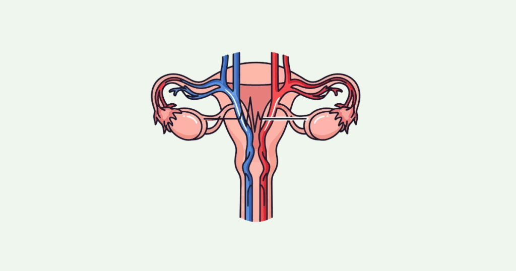 pelvic-venous-disease-treatment pelvic venous disease treatment